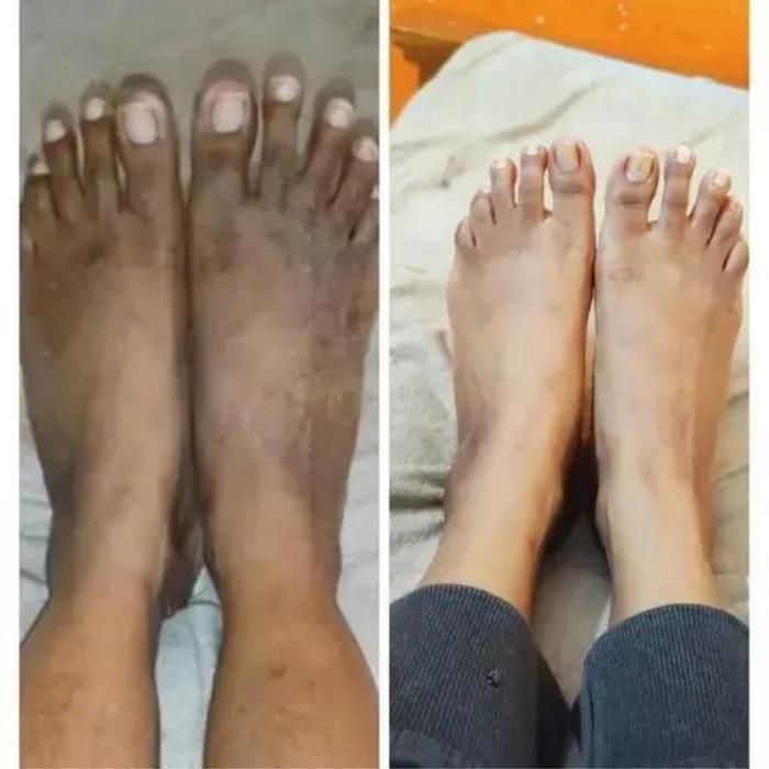 Lucacci Sinche Kojic Skin Whitening Facial Body Soap Pack of 4 - 300 g